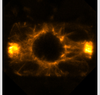 Division cellulaire chez les plantes : l’anneau de préprophase stabilise le plan de division plus qu’il ne le détermine