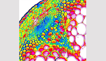 Summer school " Plant cell walls" organized by the IJPB in the framework of the SPS network