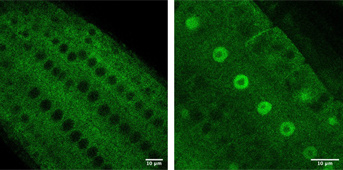 Essential Role of the “Shuttle” Protein SGS3 in Gene Silencing in the Plant Arabidopsis thaliana