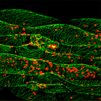 "3èmes Journées du Réseau France Microtubules" French Microtubule Network