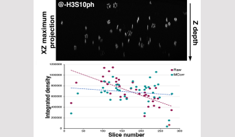 Quantification semi-automatique des signaux de phosphorylation d’une histone impliquée dans la division chez Arabidopsis